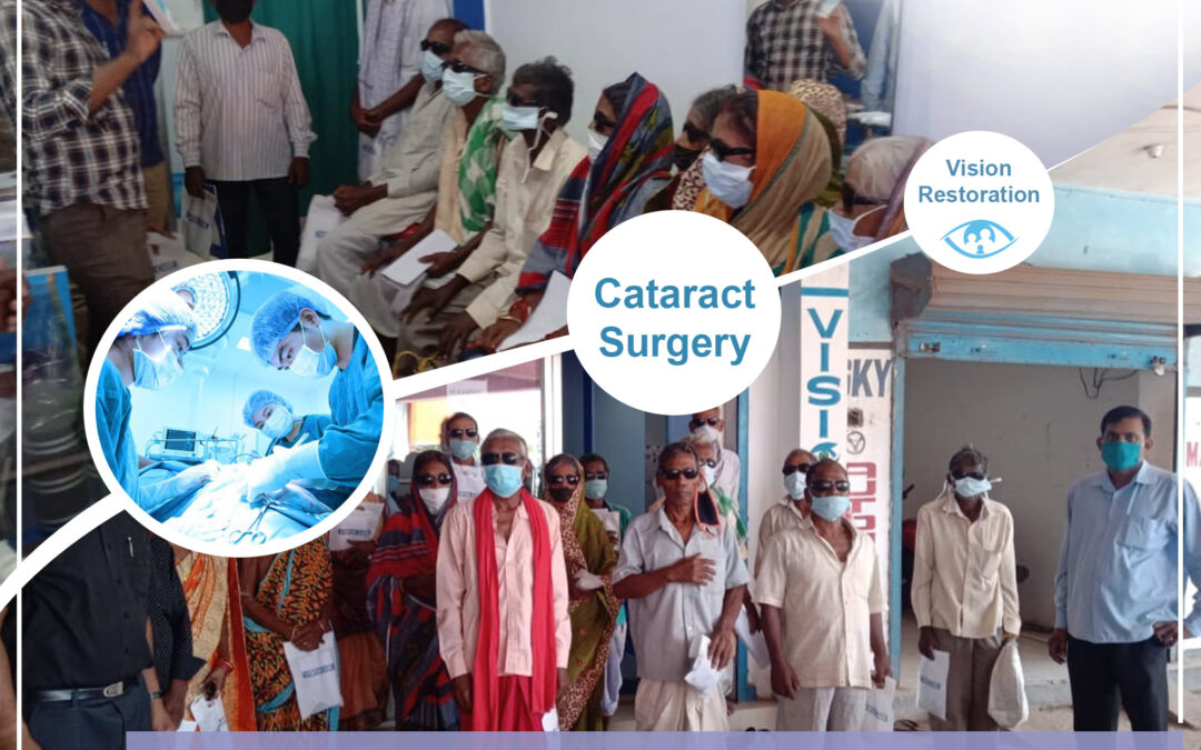 Cataract surgery